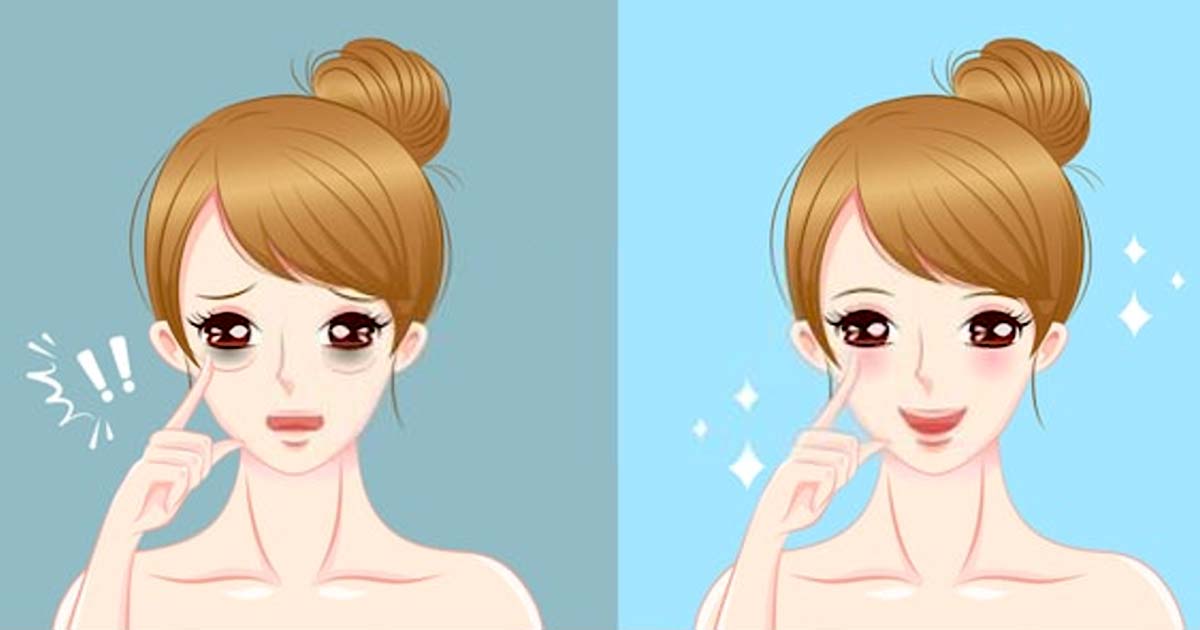 How to Get Rid of Bags under the Eyes